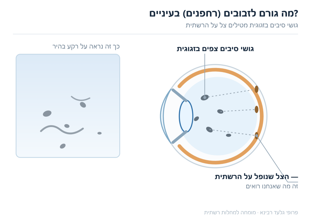 איור — גושי סיבים בזגוגית מטילים צל על הרשתית, וכך נראים הרחפנים על רקע בהיר